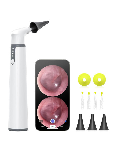 Otoscopio Inalámbrico AnyScope con Cámara y Luz 3.9mm