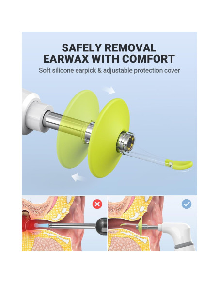 Otoscopio Inalámbrico AnyScope con Cámara y Luz 3.9mm