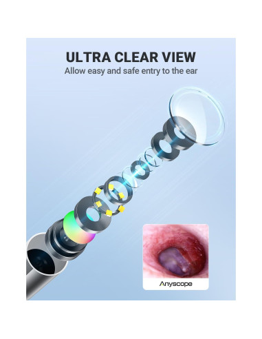 Otoscopio Inalámbrico AnyScope con Cámara y Luz 3.9mm