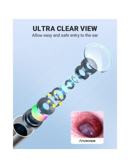 Otoscopio Inalámbrico AnyScope con Cámara y Luz 3.9mm