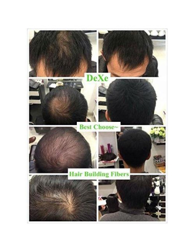 Dexe Fibras para Construir Cabello Color Marrón Medio 22g