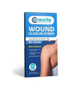 Cierre de Heridas Conkote - 40 Tiras Transpirables 15.6x8.0 cm