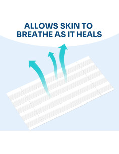 Cierre de Heridas Conkote - 40 Tiras Transpirables 15.6x8.0 cm 2