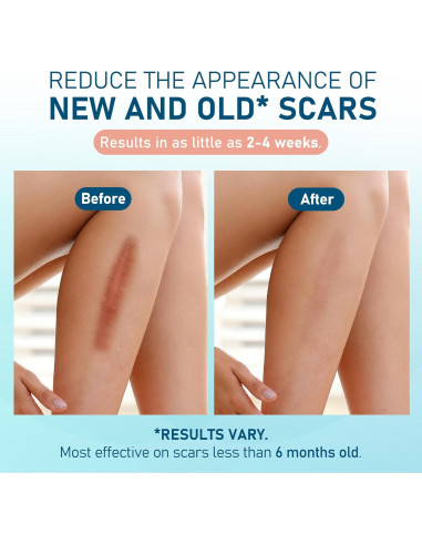 Hojas de Silicona para Cicatrices LotFancy - 10 Piezas 3.81x15.24cm