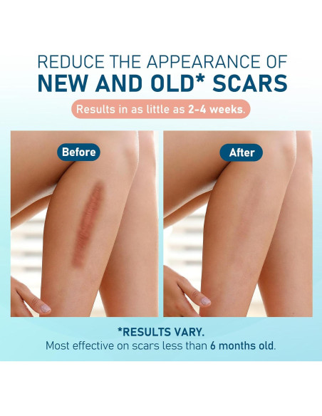 Hojas de Silicona para Cicatrices LotFancy - 10 Piezas 3.81x15.24cm