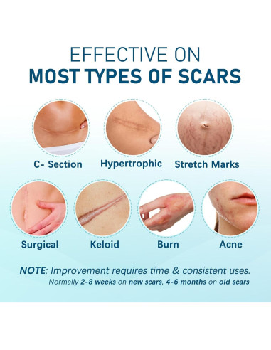 Hojas de Silicona para Cicatrices LotFancy - 10 Piezas 3.81x15.24cm