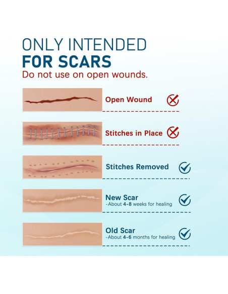 Hojas de Silicona para Cicatrices LotFancy - 10 Piezas 3.81x15.24cm