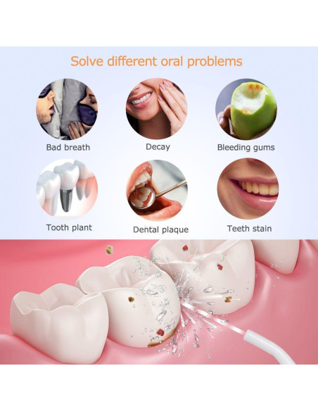 Irrigador Oral Eléctrico Prooral F5106-F1 330ml 3 Modos USB