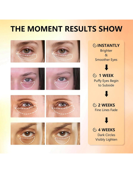 Parches para Ojos Aeryea con Vitamina C y Cafeína - 30 Pares