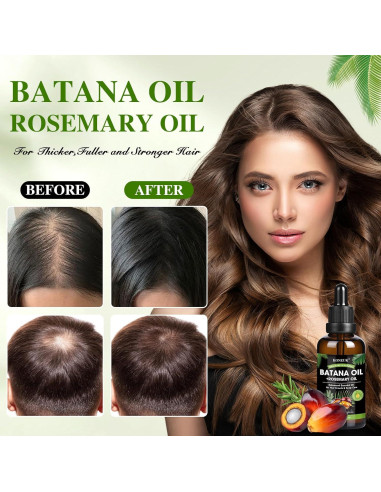 Aceite de Batana y Romero para Crecimiento del Cabello 59.87 ml