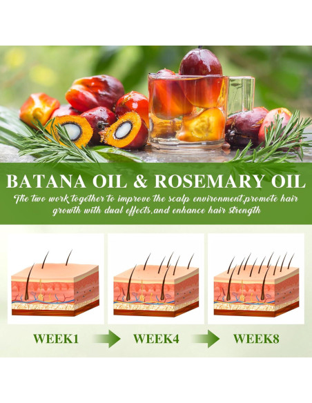 Aceite de Batana y Romero para Crecimiento del Cabello 59.87 ml