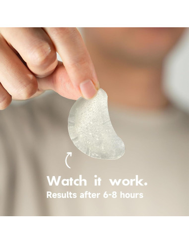 Parches para Granitos Dazzlook con Ácido Salicílico - 36 Unidades