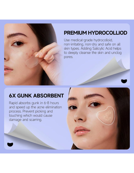 Parches para Granitos Dazzlook con Ácido Salicílico - 36 Unidades