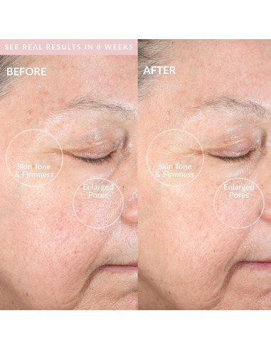 Dispositivo de Limpieza Facial PMD Clean Pro RQ con Cuarzo Rosa