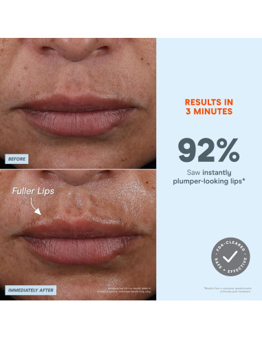 Dispositivo Facial Microcurrent NuFACE FIX Microwand - Aumento de Labios y Tratamiento para Ojos