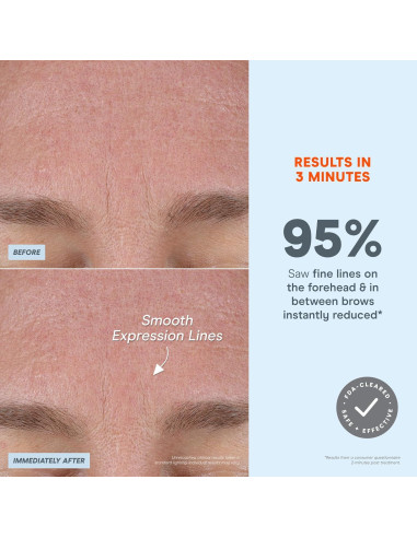 Dispositivo Facial Microcurrent NuFACE FIX Microwand - Aumento de Labios y Tratamiento para Ojos