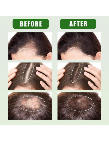 Aceite de Batana Crudo Unalakleet 230g - Crecimiento Cabello Vegano