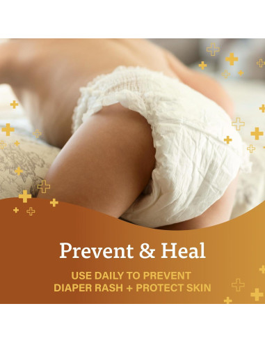 Ungüento A+D para Erupciones de Pañal 453.6 g y 113.4 g