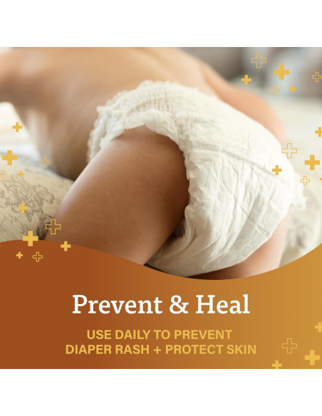 Ungüento A+D para Erupciones de Pañal 453.6 g y 113.4 g