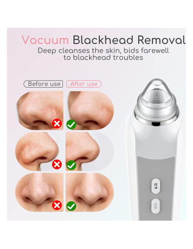 Removedor de Puntos Negros TTozka H200 con Cámara HD y 6 Cabezas