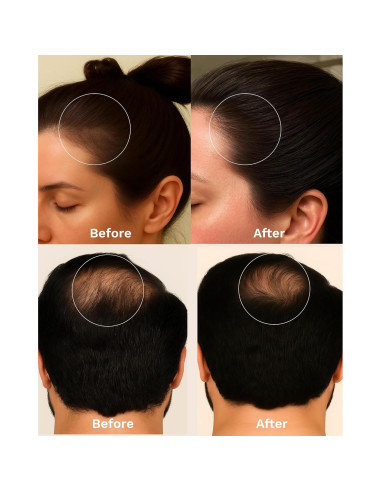 Aceite de Batana Keyoma 30 mL - Crecimiento Cabello con Romero