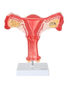 Modelo de Órganos Genitales Femeninos Axis Scientific - Anatomía Detallada