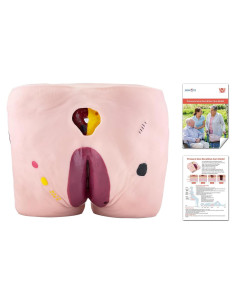Modelo de Úlcera por Decúbito JNMFTD - 4 Etapas Realistas