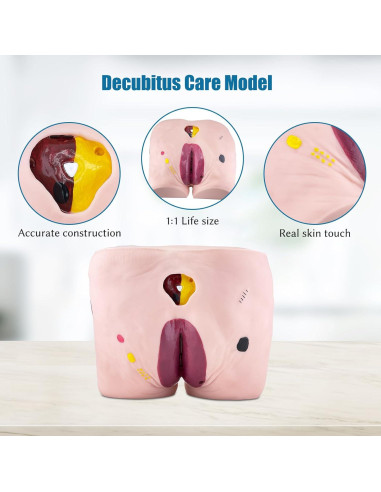 Modelo de Úlcera por Decúbito JNMFTD - 4 Etapas Realistas