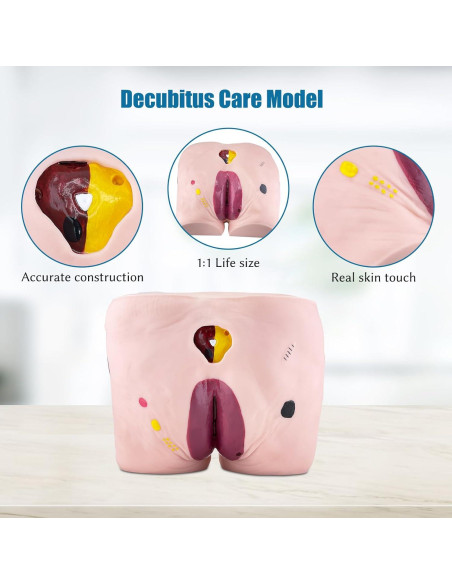 Modelo de Úlcera por Decúbito JNMFTD - 4 Etapas Realistas