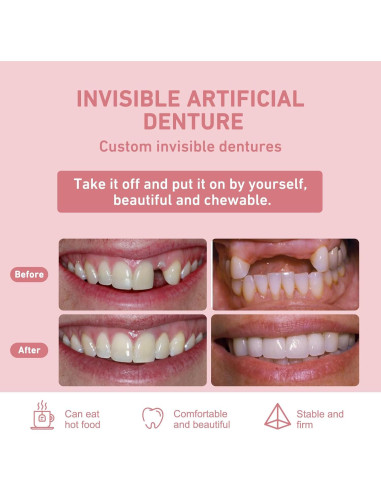 Dentadura Parcial Personalizada Mevivism para 1 Diente - Ajuste Cómodo