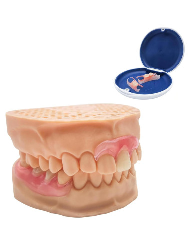 Dentadura Parcial Personalizada Mevivism para 1 Diente - Ajuste Cómodo