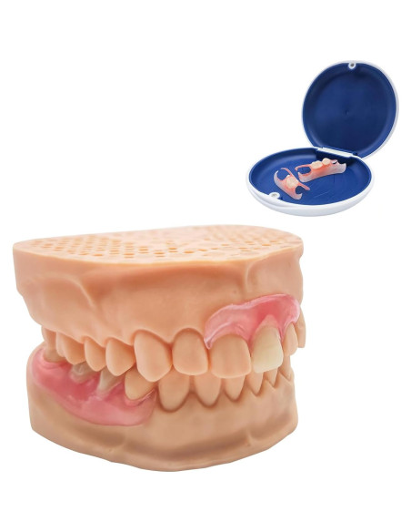 Dentadura Parcial Personalizada Mevivism para 1 Diente - Ajuste Cómodo