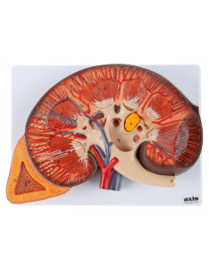 Modelo de Riñón Humano Axis Scientific 36 cm con Glándula Suprarrenal