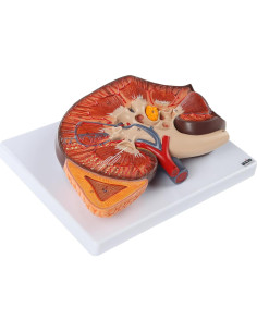 Modelo de Riñón Humano Axis Scientific 36 cm con Glándula Suprarrenal 2