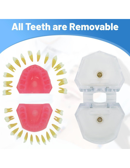 Modelo Dental Witbee con Dientes Removibles y Carcasa Transparente