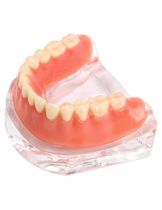 Modelo Dental Sobredentadura Desmontable Kouyot - Mandíbula Inferior