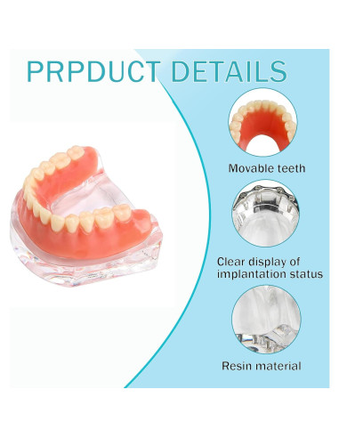 Modelo Dental Sobredentadura Desmontable Kouyot - Mandíbula Inferior