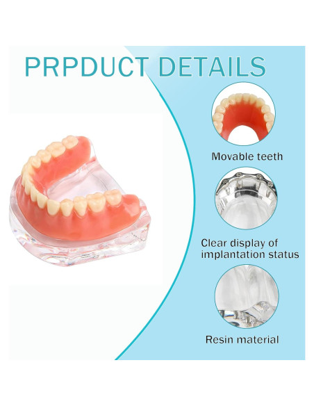 Modelo Dental Sobredentadura Desmontable Kouyot - Mandíbula Inferior