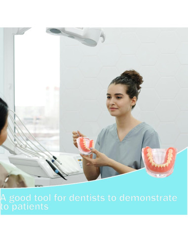 Modelo Dental Sobredentadura Desmontable Kouyot - Mandíbula Inferior