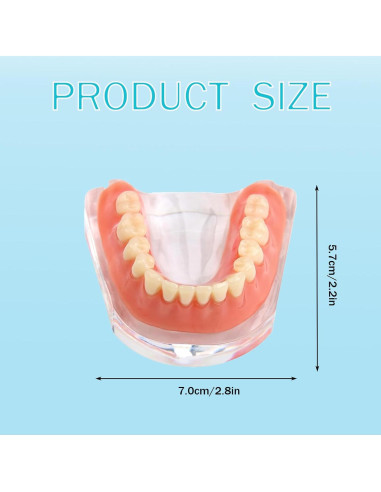 Modelo Dental Sobredentadura Desmontable Kouyot - Mandíbula Inferior