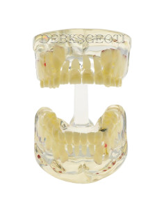 Modelo de Dientes Pediátrico Typodont DTM-4002 para Niños