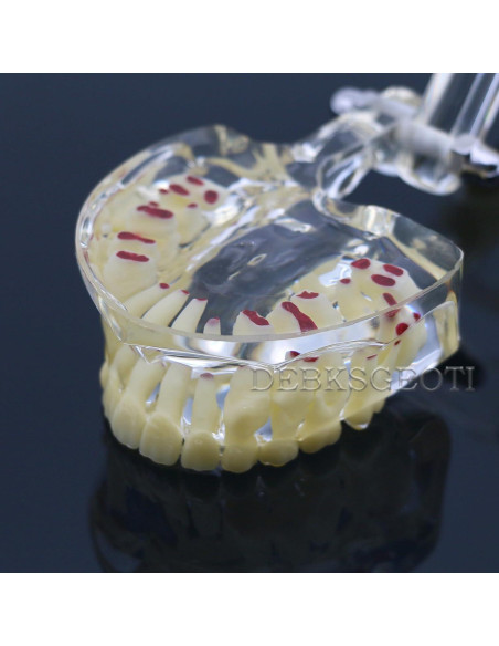 Modelo de Dientes Pediátrico Typodont DTM-4002 para Niños