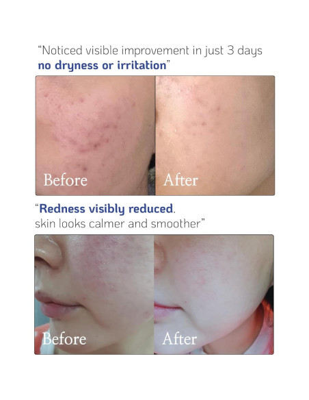 Concentrado de Ceramida Nano Recipe 41ml - Hidratante Regenerador