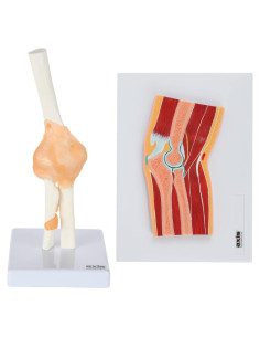 Modelo de Anatomía Articulación del Codo Axis Scientific