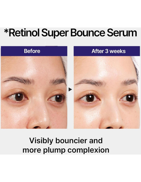 Suero Super Bounce IOPE Retinol 49.8 ml Antiarrugas 0.1%