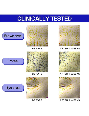 Suero Antiarrugas IOPE Retinol 49.8 ml + PDRN Cafeína