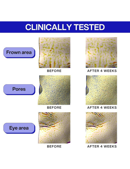 Suero Antiarrugas IOPE Retinol 49.8 ml + PDRN Cafeína