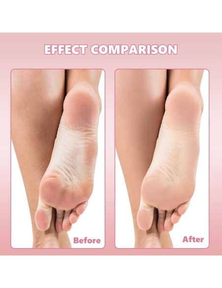 Recambios de Lima de Pie Flutesan 80 Pcs Acero Inoxidable 180/120 Grano