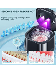 Limpiadora Ultrasónica de Retenedores Alitake 45kHz - Negro 2