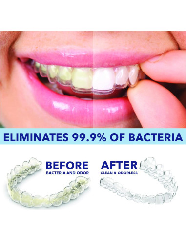 Limpiador Natural para Dentaduras y Retenedores CustMBite 100ml